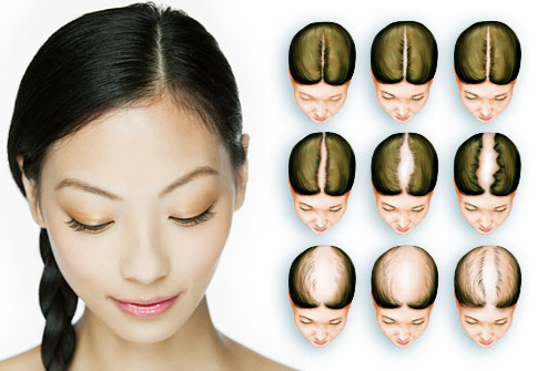 how to regrow lost frontal hair